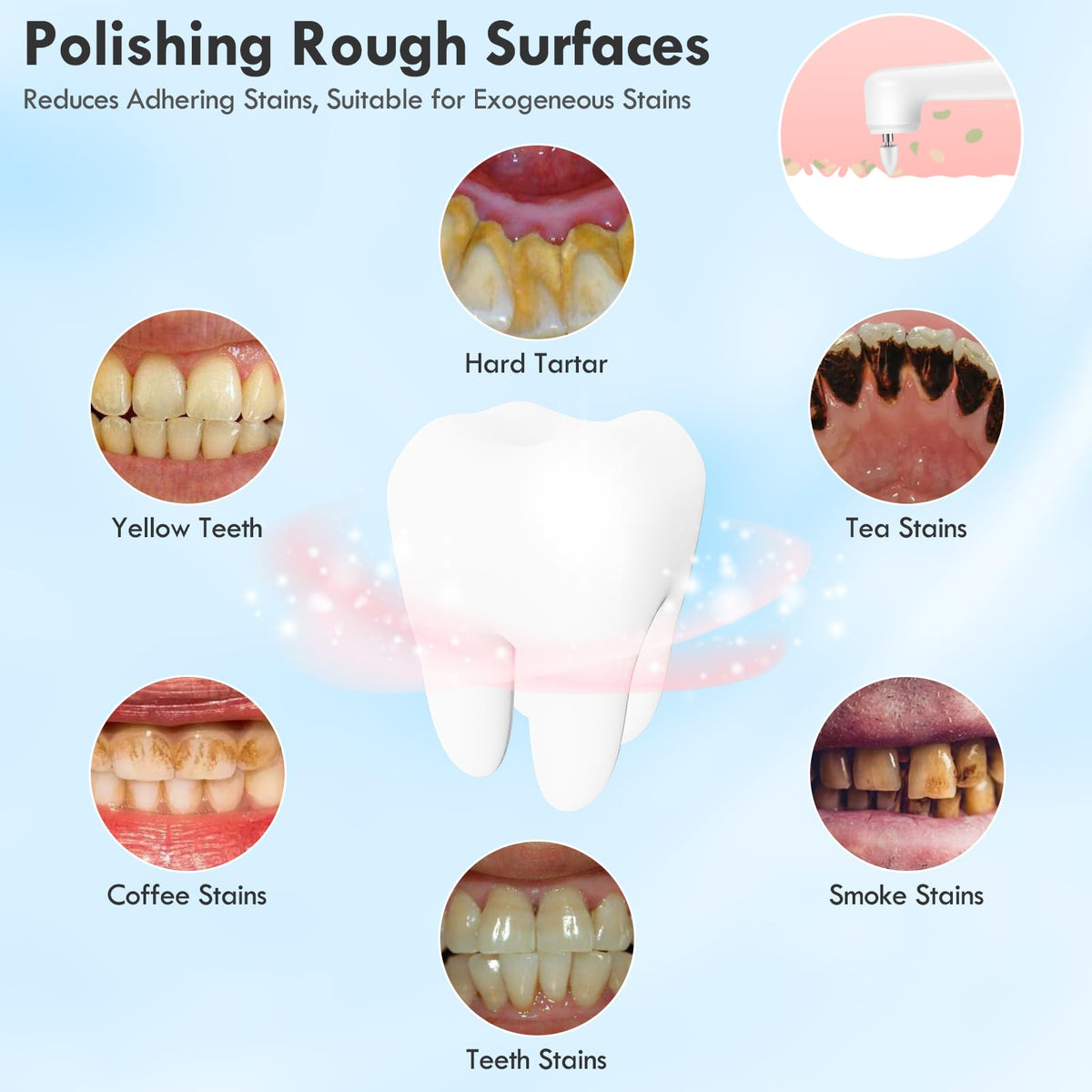 Pelzzle Rechargeable Tooth Polisher Kit for Daily Cleaning, Whitening and Polishing, Electric Dental Teeth Polisher with LED Light, 5 Brush Heads, 5 Speed Modes, Waterproof Pelzzle