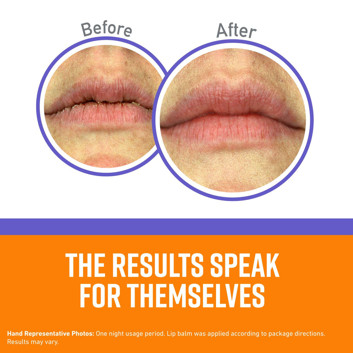 O'Keeffe's Night Treatment Combo Pack Including Working Hands Night Treatment Hand Cream, Healthy Feet Night Treatment Foot Cream and Lip Repair O'Keeffe's