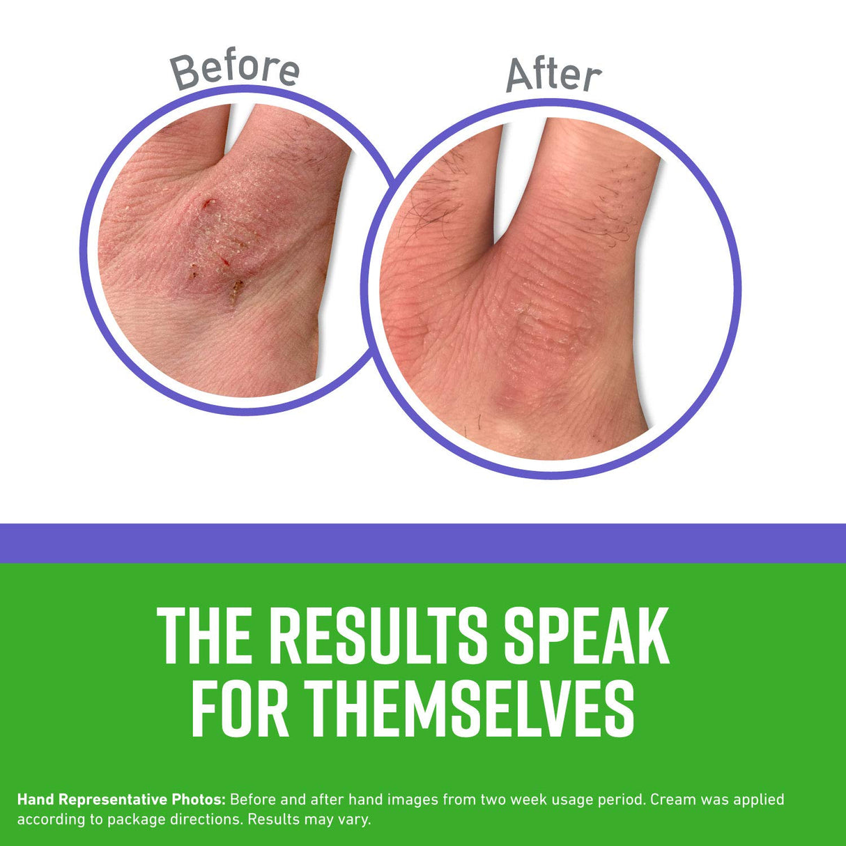 O'Keeffe's Night Treatment Combo Pack Including Working Hands Night Treatment Hand Cream, Healthy Feet Night Treatment Foot Cream and Lip Repair O'Keeffe's