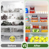 KEMETHY 36-Piece Food Storage Containers with Lids(18 Containers & 18 Lids), Plastic Food Containers for Pantry & Kitchen Storage and Organization, BPA-Free, Leak Proof, Reusable with Labels & Pen KEMETHY