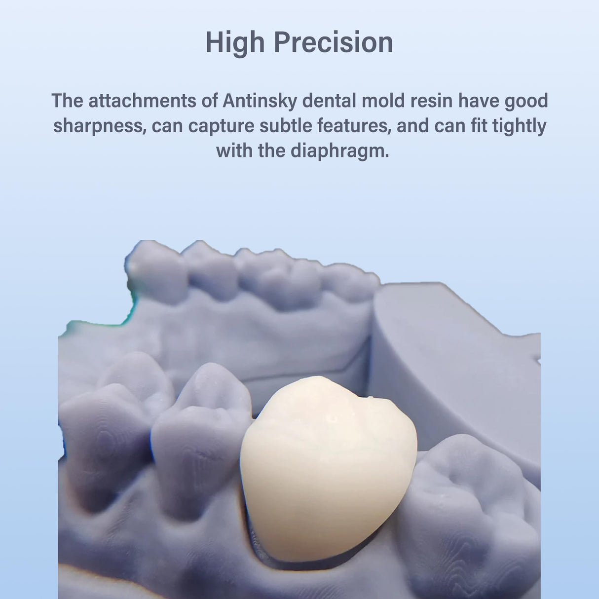 Antinsky Temporary Dental Model Resin for DLP LCD 3D Printer Resin 405nm High Precision High Hardness Fast Cure Time Teeth Textured Appearance Teeth Color A1 500g Antinsky