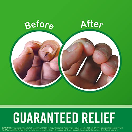 O'Keeffe's Working Hands Hand Cream for Extremely Dry, Cracked Hands, 3.4 Ounce Jar, (Pack 1) O'Keeffe's