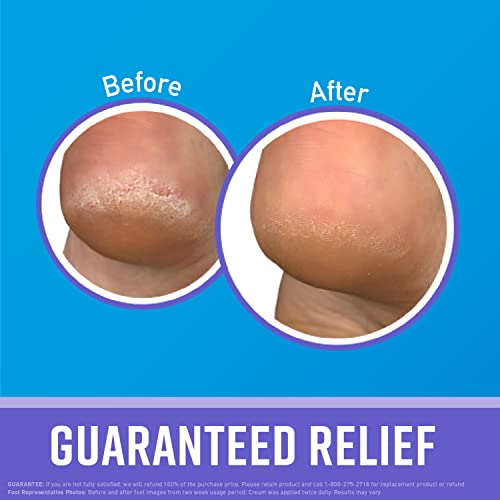 O'Keeffe's Working Hands Night Treatment Hand Cream and Healthy Feet Night Treatment Foot Cream, 7 Ounce Tube O'Keeffe's