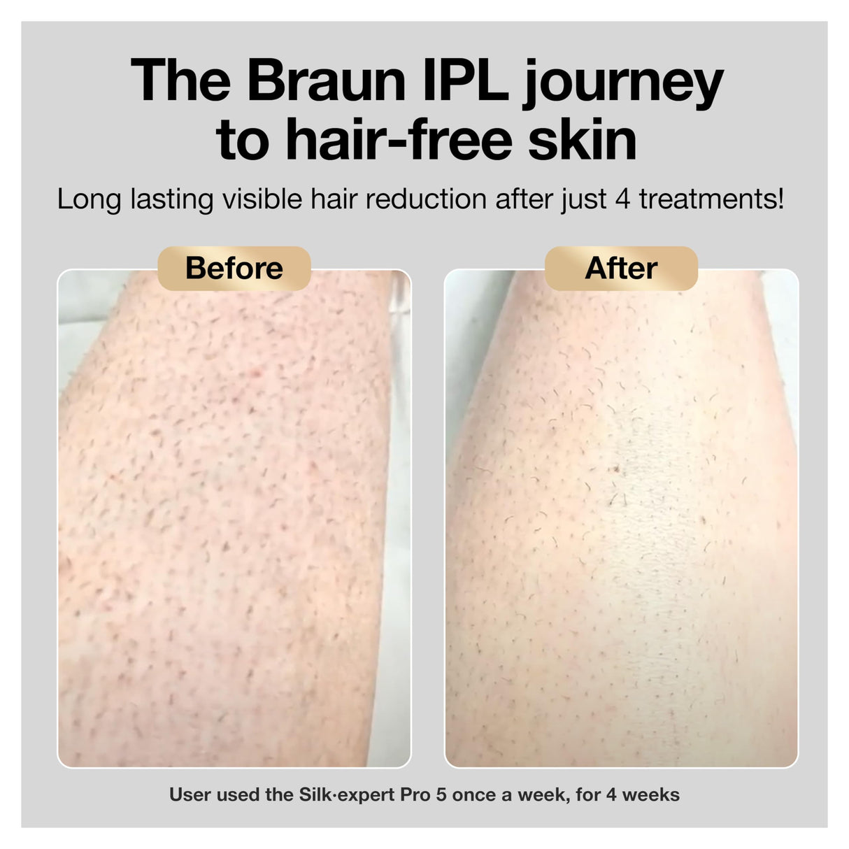 Braun IPL Long-lasting Laser Hair Removal Device for Women & Men, Silk Expert Pro5 PL5157, Safe & Virtually Painless Alternative to Salon Laser Hair Braun