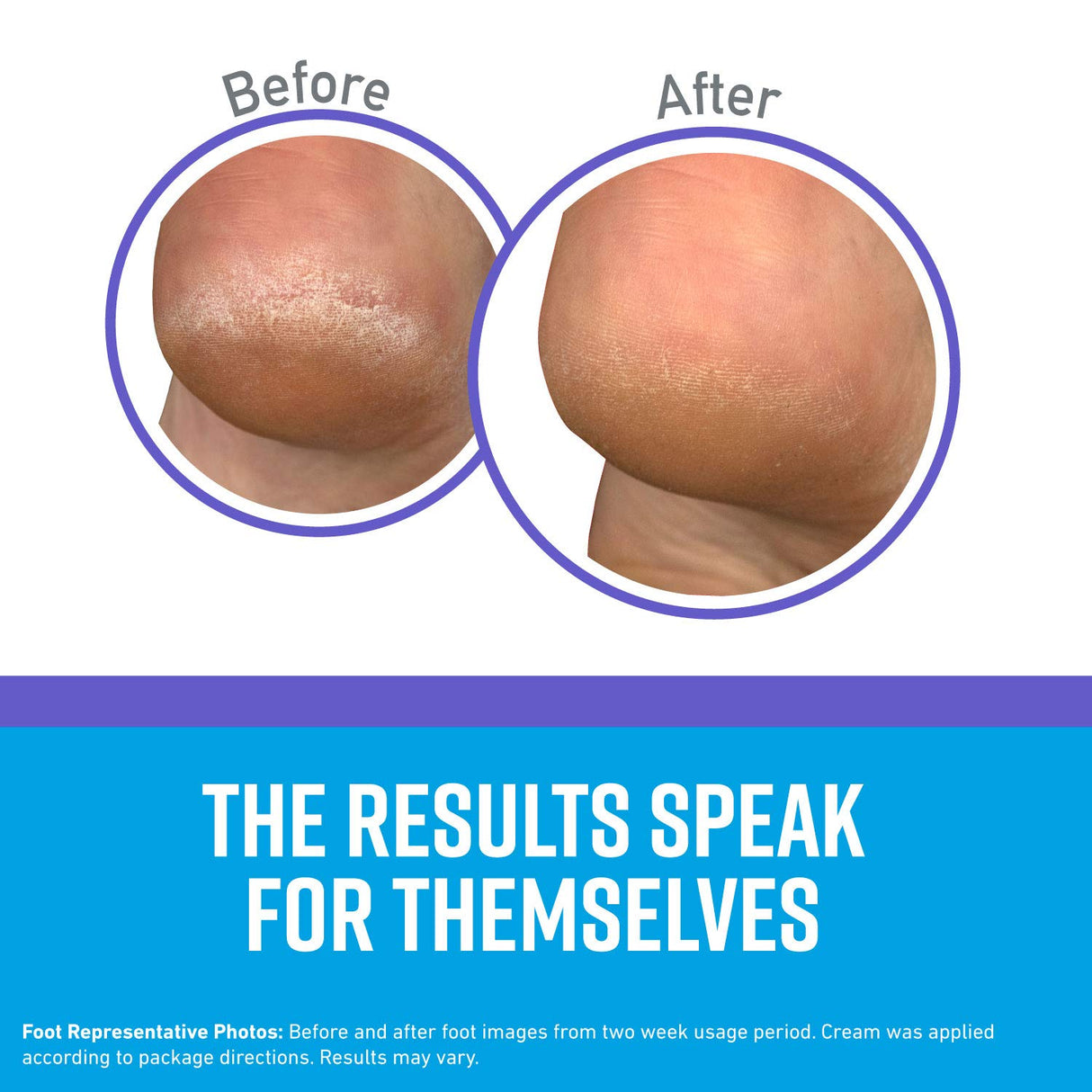 O'Keeffe's Night Treatment Combo Pack Including Working Hands Night Treatment Hand Cream, Healthy Feet Night Treatment Foot Cream and Lip Repair O'Keeffe's